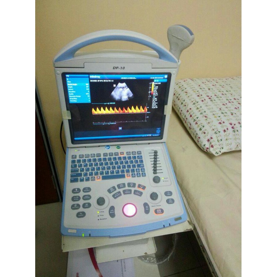 Jasa-Import-Alat-USG-081398881288.jpg